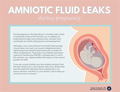 treatment for leaking amniotic fluid|Leaking Amniotic Fluid: How to Tell